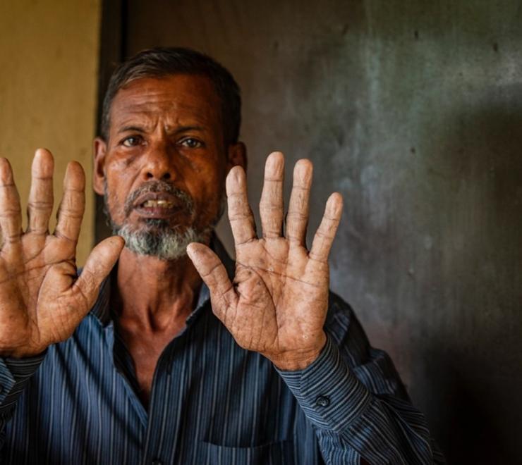 Abdul Hai, 59, lost his home and livestock in the floods and has sought refuge in a school with his family of nine.